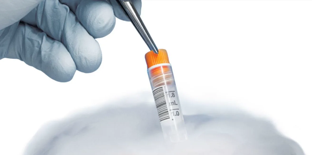 Custom cryogenic labels on a sample vial being removed from liquid nitrogen storage at -196°C